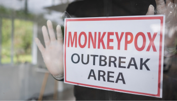 Essential Tools for Monkeypox (Mpox) Research